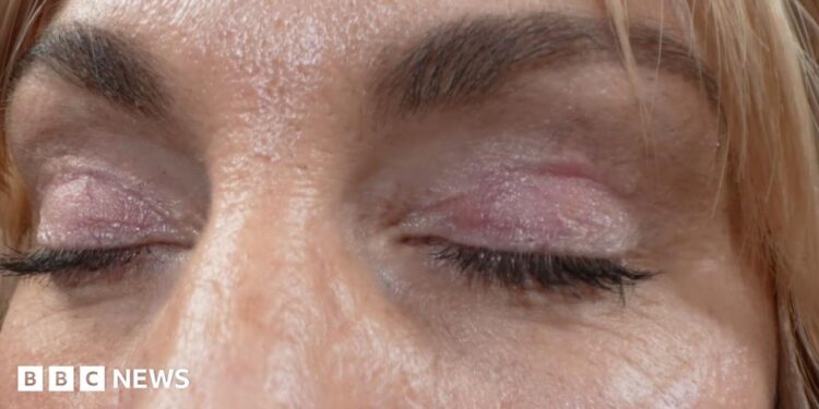 ‘My eyelids became infected – I was scared to sleep’