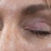 ‘My eyelids became infected – I was scared to sleep’